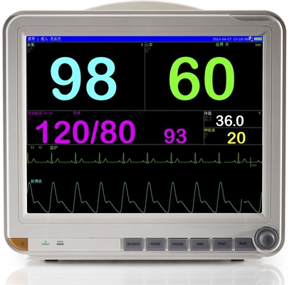 Monitor paciente del multiparámetro portátil de 15 pulgadas con ECG, RESP, NIBP, TEMPOREROS, hora