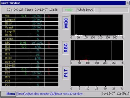 Analizador de Hematología de Auto blanco con método de resistencia eléctrica para contar
